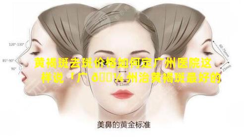 黄褐斑去斑价格如何定广州医院这样说「广 🐼 州治黄褐斑最好的专家是 💐 哪些」